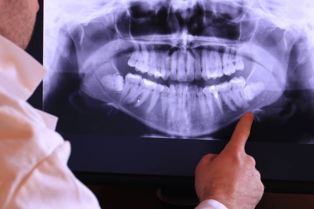 Best Emergency Dental Extractions in Bad Axe, MI