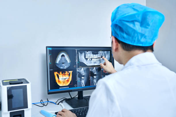 Best Emergency Root Canal Treatment in Bad Axe, MI