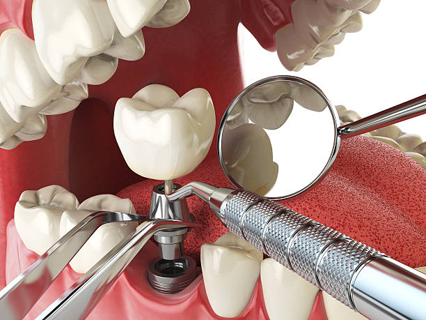 Best Mobile Emergency Dentist in Bad Axe, MI